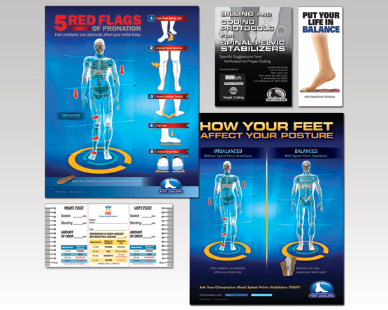 Adult Acquired Flat Feet