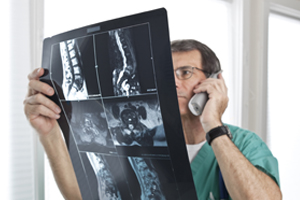 Spinal Degeneration
