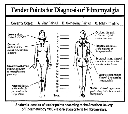 ender points for diagnosis of fibromyalgia
